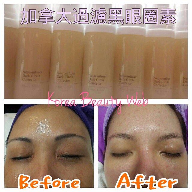 ProTop neuroinfuser dark circle corrector 加拿大過濾黑眼圈素 ProTop neuroinfuser dark circle corrector 加拿大過濾黑眼圈素