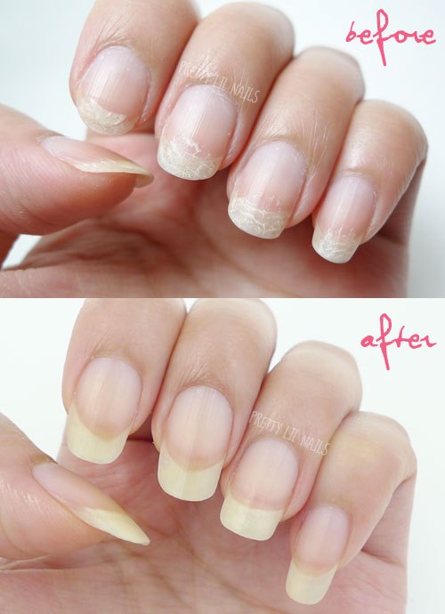 Duri Rejuvacote 2 Nail Growth Treatment