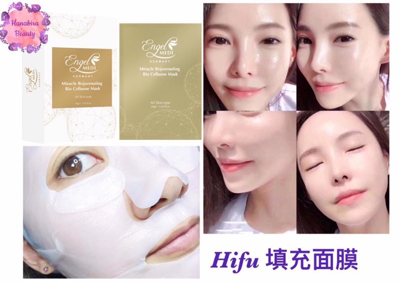 Engel Midi Hifu 填充面膜 Engel Midi Hifu 填充面膜