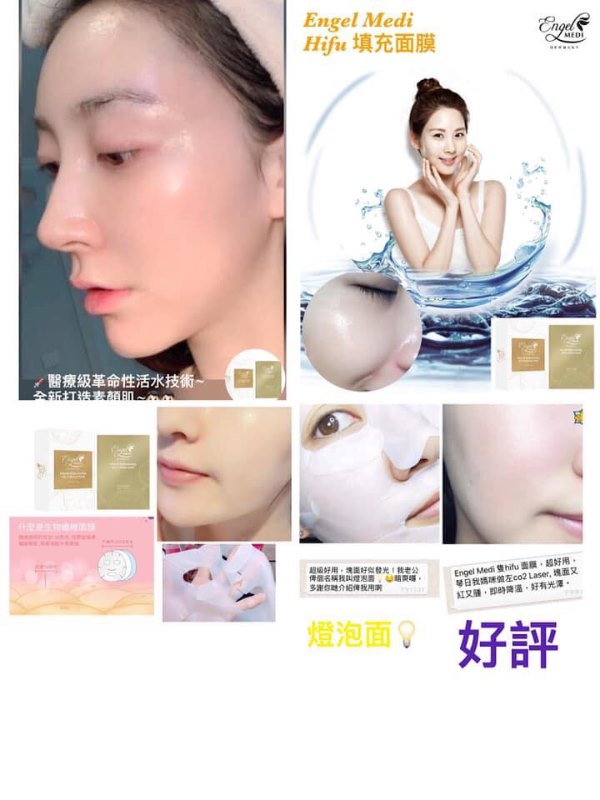 Engel Midi Hifu 填充面膜 Engel Midi Hifu 填充面膜
