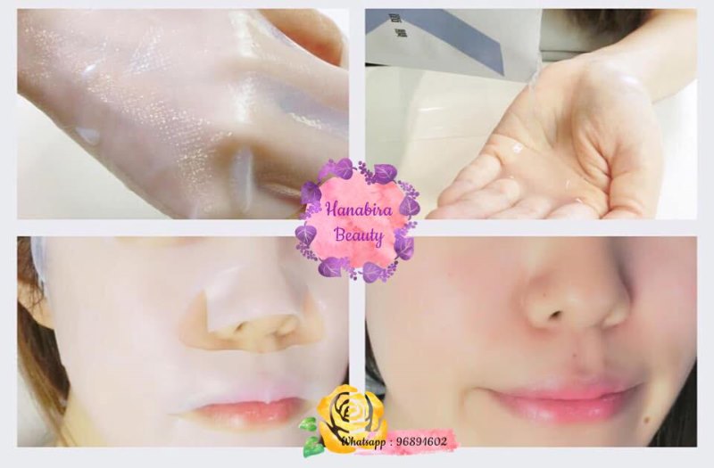 Engel Midi Hifu 填充面膜 Engel Midi Hifu 填充面膜