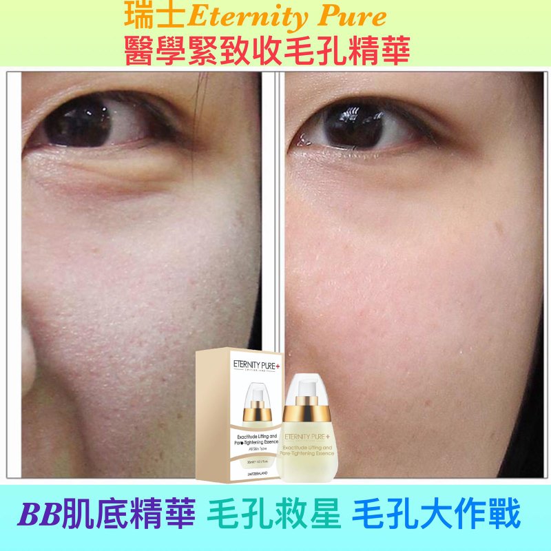瑞士Eternity Pure 醫學緊緻收毛孔精華 30ml 瑞士Eternity Pure 醫學緊緻收毛孔精華 30ml