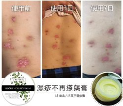 南非 LE Naturel 古法萬用濕疹膏 100ml