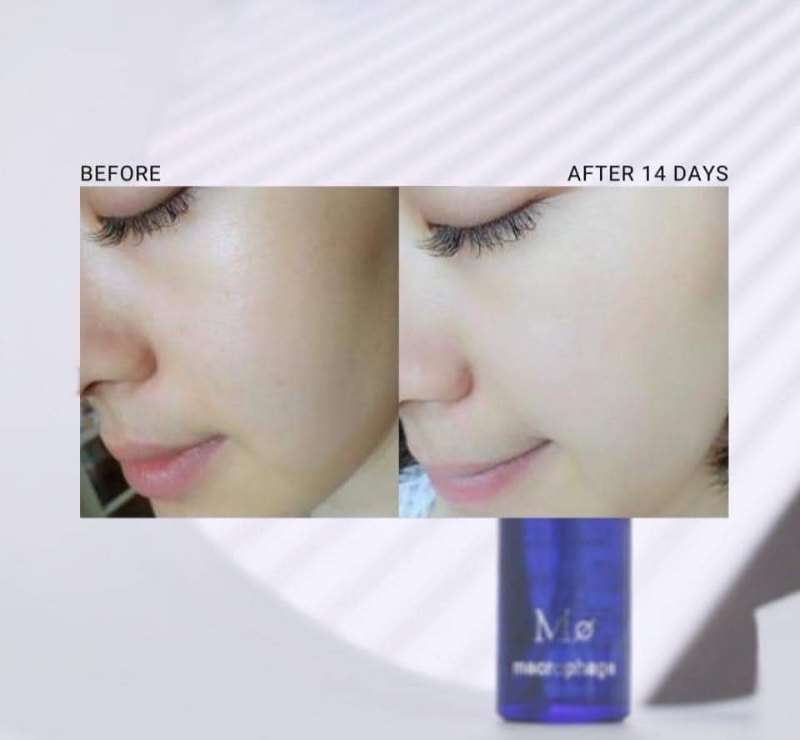 日本 Belle Coeur 速效美白神水Macrophage No.2 Whitening Essence 30ml