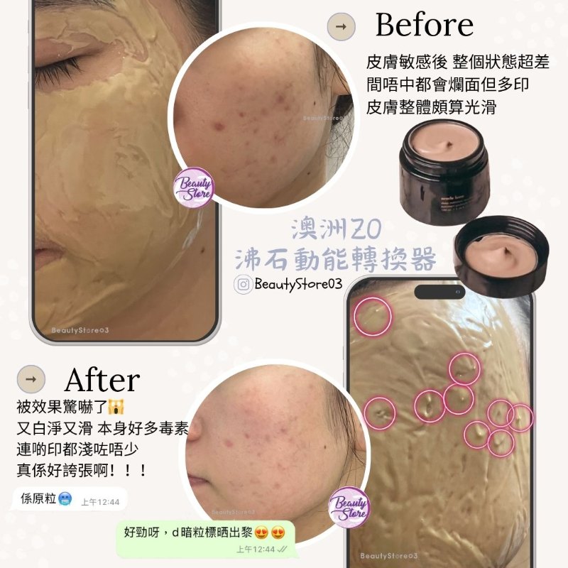 澳洲 ZO Oracle Lume – Deep Nutriment Resurfacing Masque 沸石動能轉換器 100ml