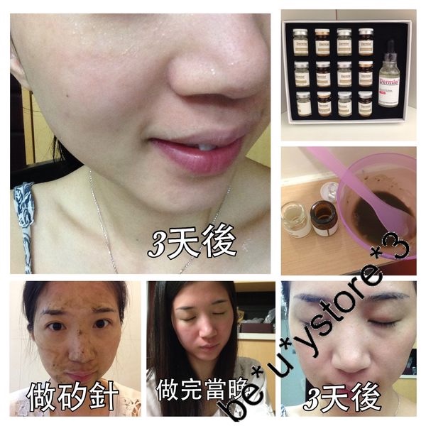 英國 Dermier 海藻矽針煥膚療程 單set 英國 Dermier 海藻矽針煥膚療程 單set