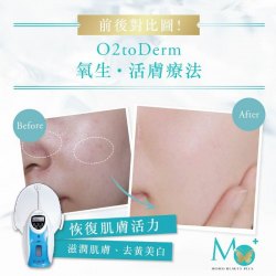 O2toDerm 氧生.活膚療法  (注氧太空罩療程)