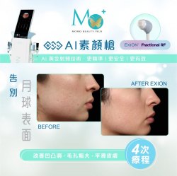 BTL EXION AI智能素顏槍