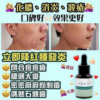 X LUXURY 女皇奇蹟粉刺水 30ml X LUXURY 女皇奇蹟粉刺水 30ml