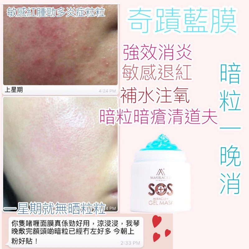 Mmiracle+ SOS急救系列奇蹟藍膜 Mmiracle+ SOS急救系列奇蹟藍膜