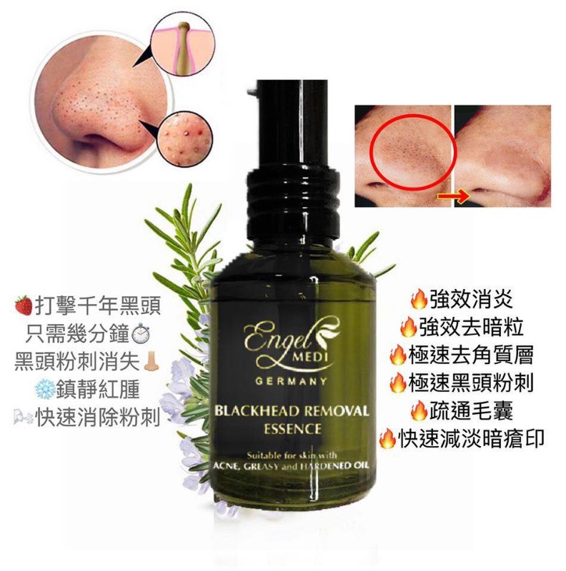 Engel Medi 强力黑頭粉刺水 30ml Engel Medi 强力黑頭粉刺水 30ml
