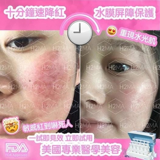 美國H2MA 細胞修復精華(2mlx15) 美國H2MA 細胞修復精華(2mlx15)