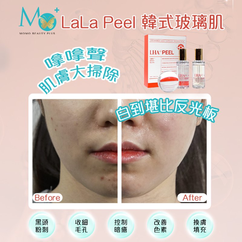LHA LaLa PeelFill 韓式玻璃肌 LHA LaLa PeelFill 韓式玻璃肌
