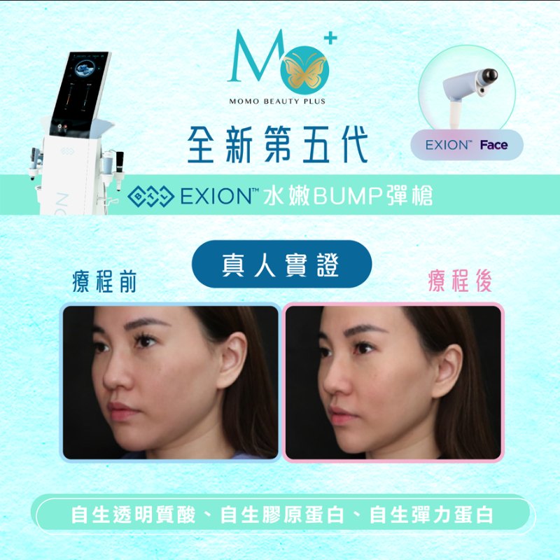 BTL EXION 第五代 水嫩Bump彈槍 BTL EXION 第五代 水嫩Bump彈槍