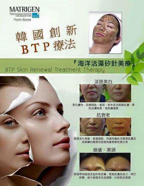 MATRIGEN B Tox Peel 海藻矽針 一SET VIP 9折 MATRIGEN B Tox Peel 海藻矽針 一SET VIP 9折