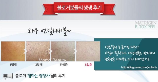 MATRIGEN B Tox Peel 海藻矽針一盒跟MASK MATRIGEN B Tox Peel 海藻矽針一盒跟MASK