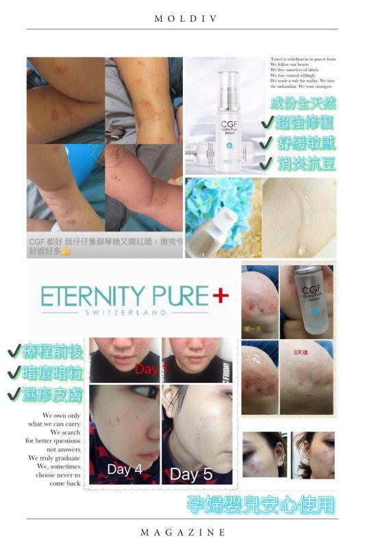 Eternity Pure CGF 幹細胞修護再生精華 35ml Eternity Pure CGF 幹細胞修護再生精華 35ml