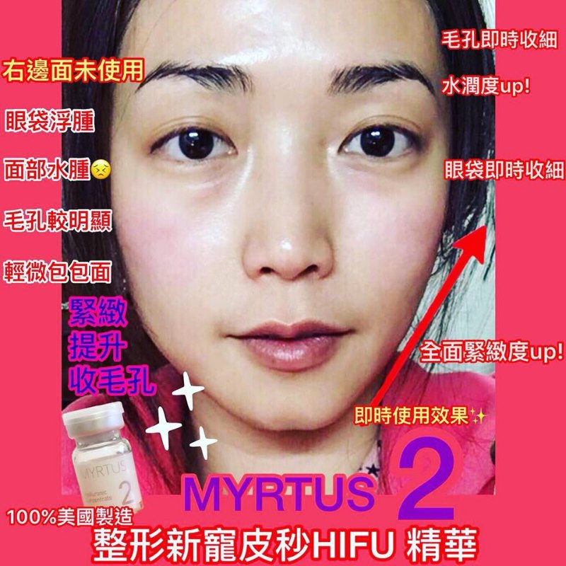 Myrturious 皮秒奇蹟修復套裝 (皮秒Hifu精華3枝 + 皮秒面膜 3片) Myrturious 皮秒奇蹟修復套裝 (皮秒Hifu精華3枝 + 皮秒面膜 3片)