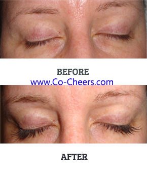 Nutraluxe Lash MD 3ml Nutraluxe Lash MD 3ml