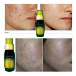 Eternity Pure 細胞修復消炎精華液 (40ml) Eternity Pure 細胞修復消炎精華液 (40ml)