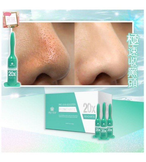 Protop Renovate 黑頭針 (3ml*10) Protop Renovate 黑頭針 (3ml*10)