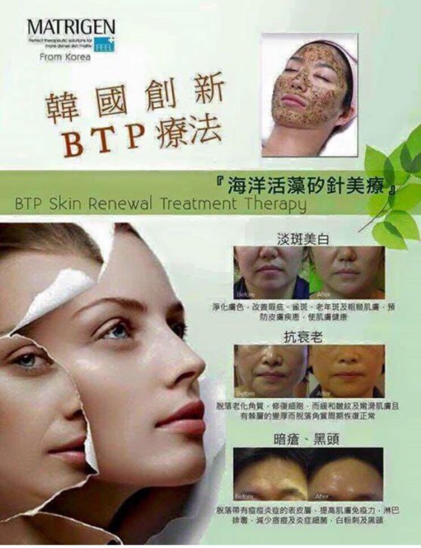 MATRIGEN B Tox Peel 海藻矽針 跟幹細胞 MATRIGEN B Tox Peel 海藻矽針 跟幹細胞