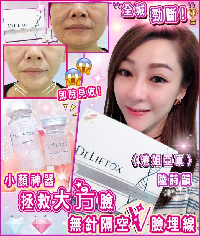Deliftox SF Uplift Treatment 隔空埋線 (羽毛線 0.09Gx3 + 緊緻拉提埋線露 5mlx3) Deliftox SF Uplift Treatment 隔空埋線 (羽毛線 0.09Gx3 + 緊緻拉提埋線露 5mlx3)