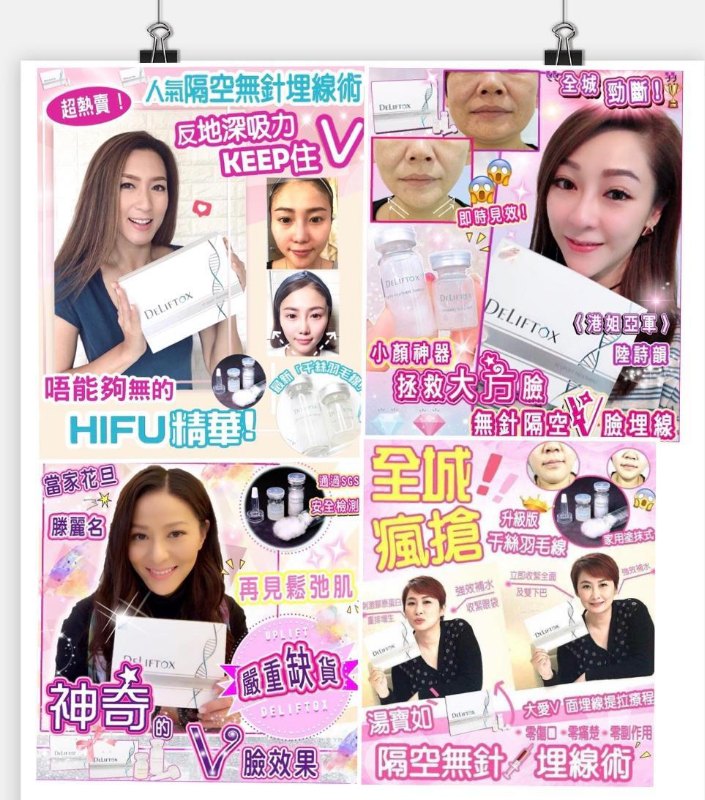 Deliftox SF Uplift Treatment 隔空埋線 (羽毛線 0.09Gx3 + 緊緻拉提埋線露 5mlx3) Deliftox SF Uplift Treatment 隔空埋線 (羽毛線 0.09Gx3 + 緊緻拉提埋線露 5mlx3)