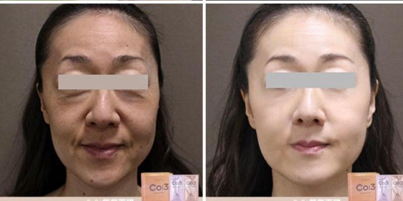 So Joli 初生注氧CO3 MASK (10次裝) So Joli 初生注氧CO3 MASK (10次裝)