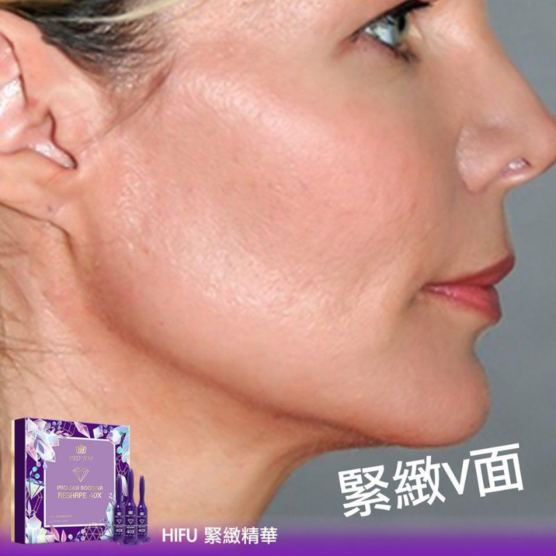 Protop 40x HIFU 精華 (3MLX10) Protop 40x HIFU 精華 (3MLX10)