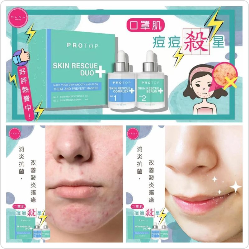 Protop 口罩肌爛面救星 滅絕暗粒暗瘡套裝 Protop 口罩肌爛面救星 滅絕暗粒暗瘡套裝
