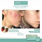Protop Pore Refine 嫩肌針 (收毛孔/減少暗粒)5mlx10 Protop Pore Refine 嫩肌針 (收毛孔/減少暗粒)5mlx10