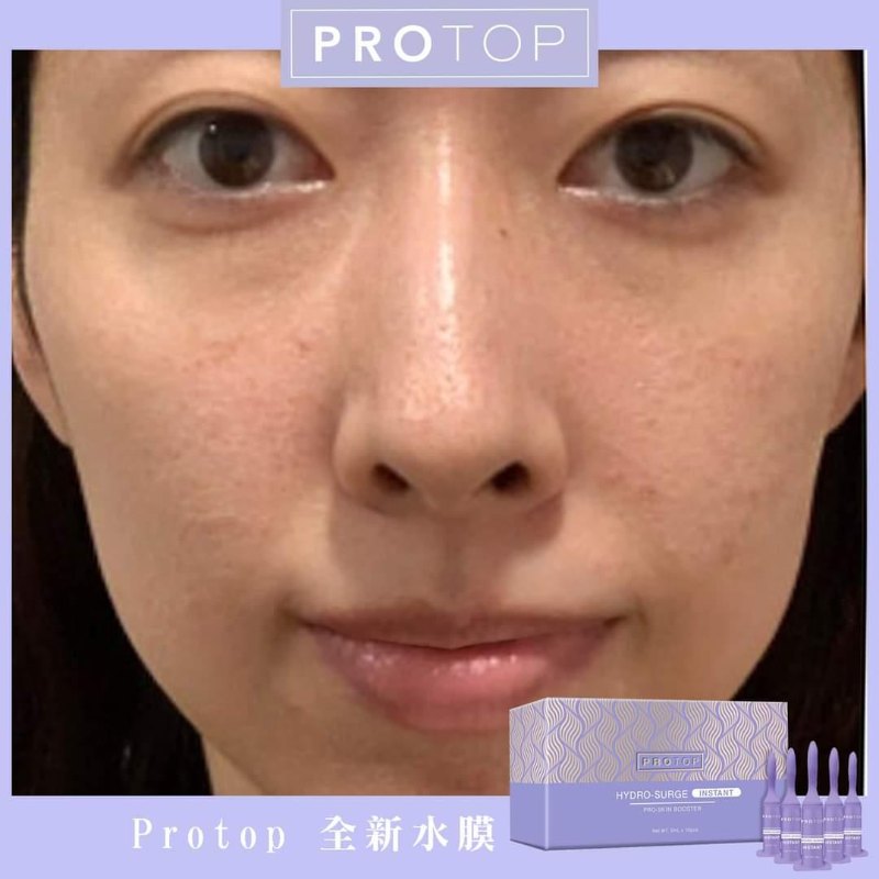 Protop 全新水膜 緊緻+祛皺+注水 禦齡針 5MLx10 Protop 全新水膜 緊緻+祛皺+注水 禦齡針 5MLx10