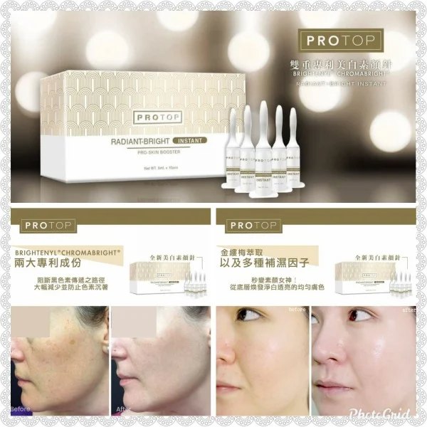 Protop 美白素顏針 (5MLX10) Protop 美白素顏針 (5MLX10)