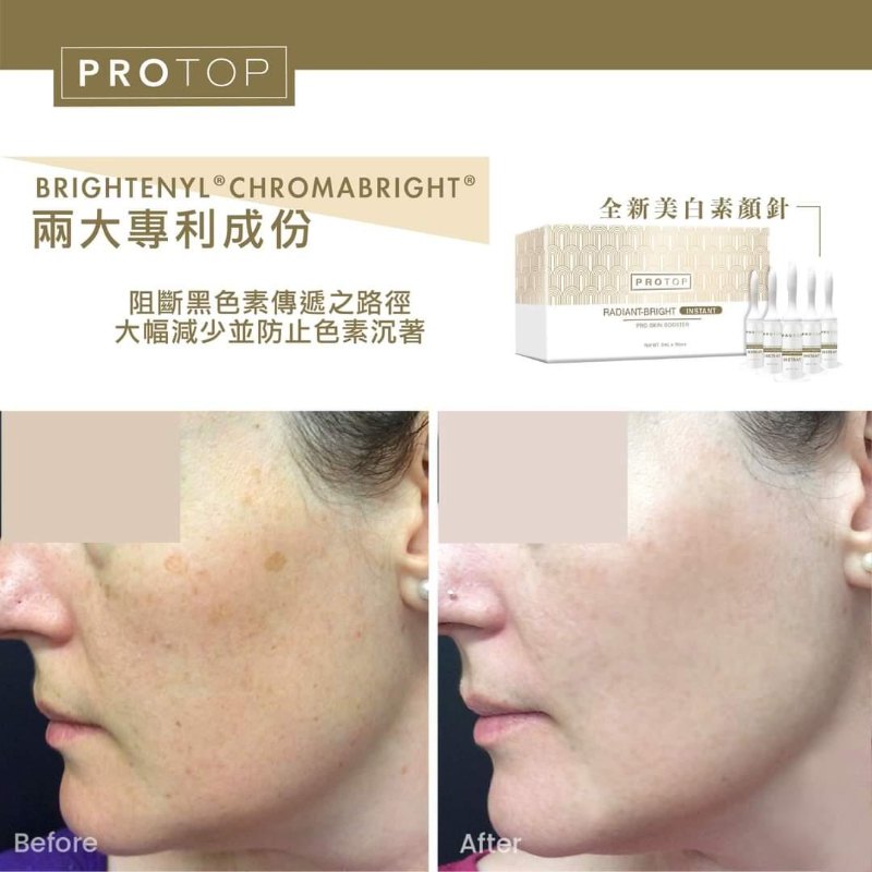 Protop 美白素顏針 (5MLX10) Protop 美白素顏針 (5MLX10)