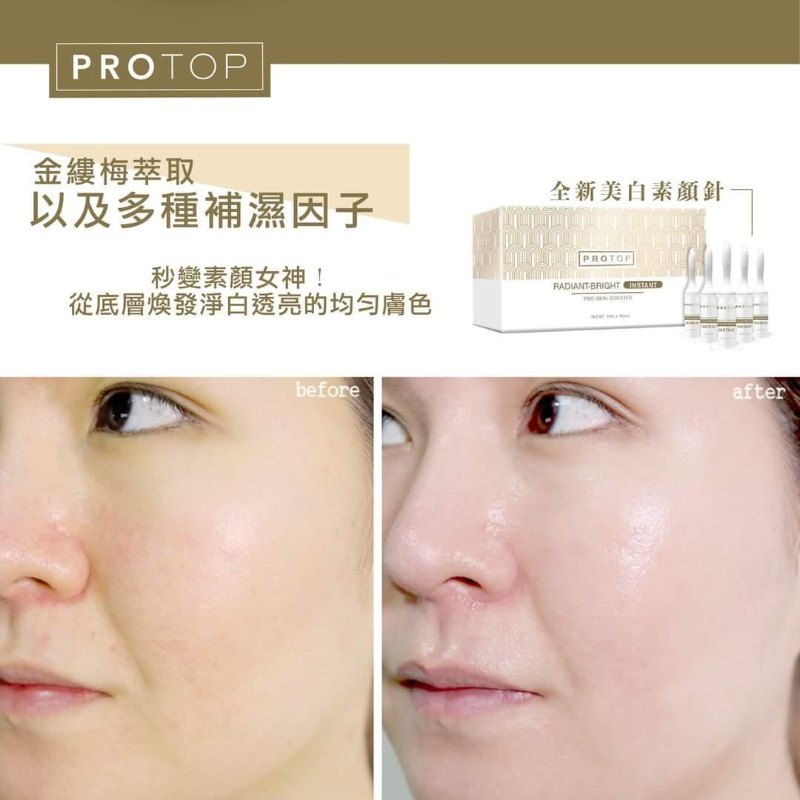 Protop 美白素顏針 (5MLX10) Protop 美白素顏針 (5MLX10)
