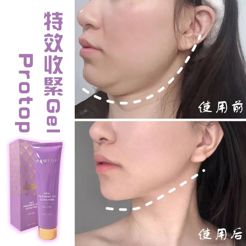 Protop 重塑年輕V型緊緻HIFU GEL (150ml)*2 Protop 重塑年輕V型緊緻HIFU GEL (150ml)*2