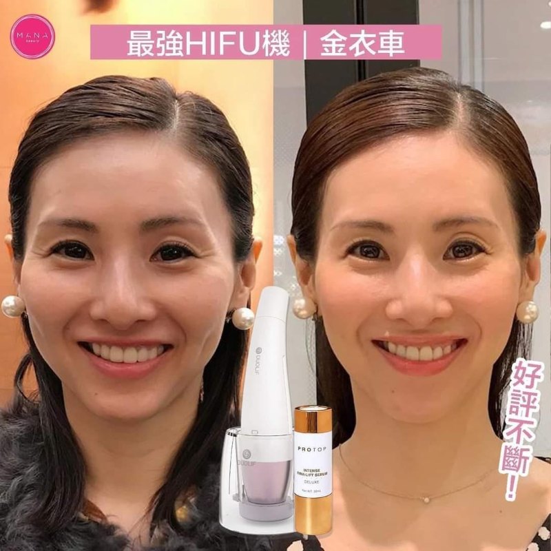 韓國Duolif 升級版家用HIFU+RF射頻雙效美容儀 + $499 換購3枝Protop HIFU 導入啫喱 (150MLX3) 送神秘禮物 韓國Duolif 升級版家用HIFU+RF射頻雙效美容儀 + $499 換購3枝Protop HIFU 導入啫喱 (150MLX3) 送神秘禮物