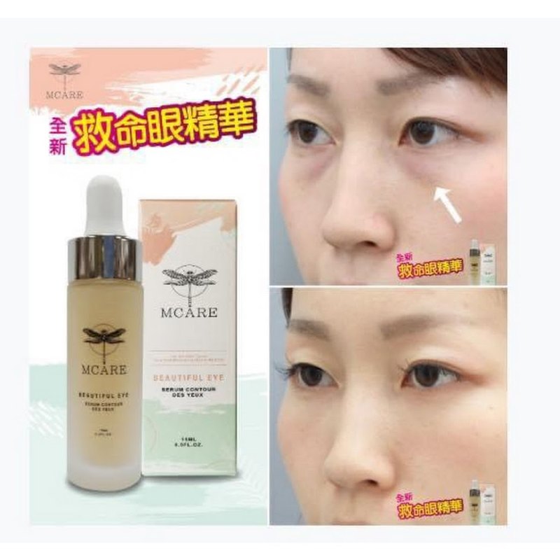 MCARE 韓國救命眼精華 (15ML) 全方位眼部輪廓定點精華 MCARE 韓國救命眼精華 (15ML) 全方位眼部輪廓定點精華